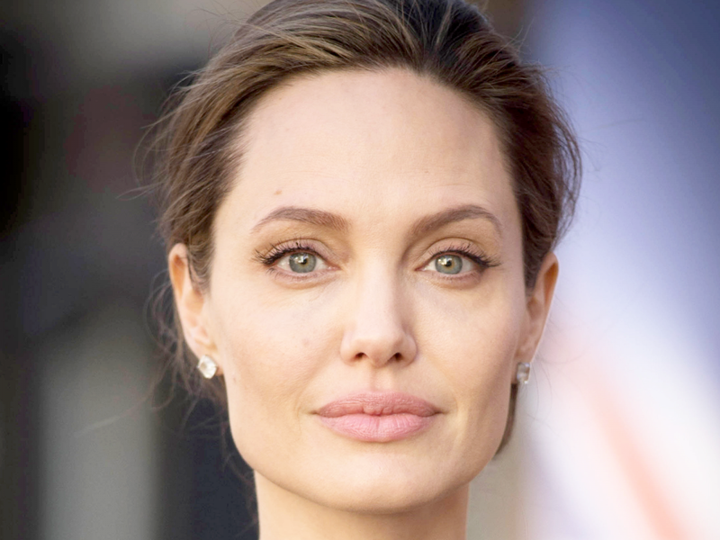 Dieu it biet ve benh liet nua mat Angelina Jolie mac phai